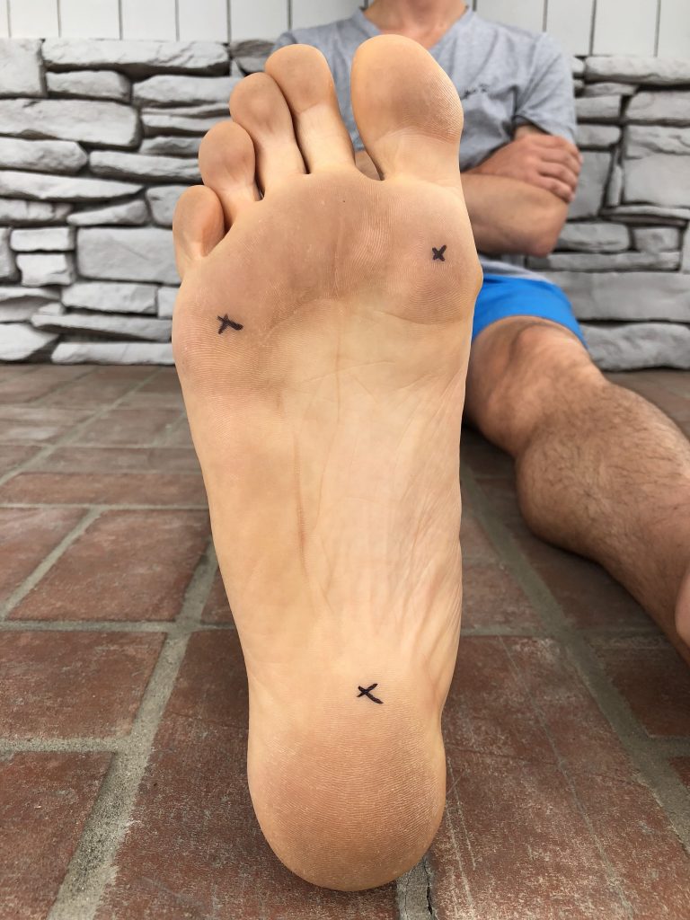 Healing Foot Pain Focus on Function IPA Physio