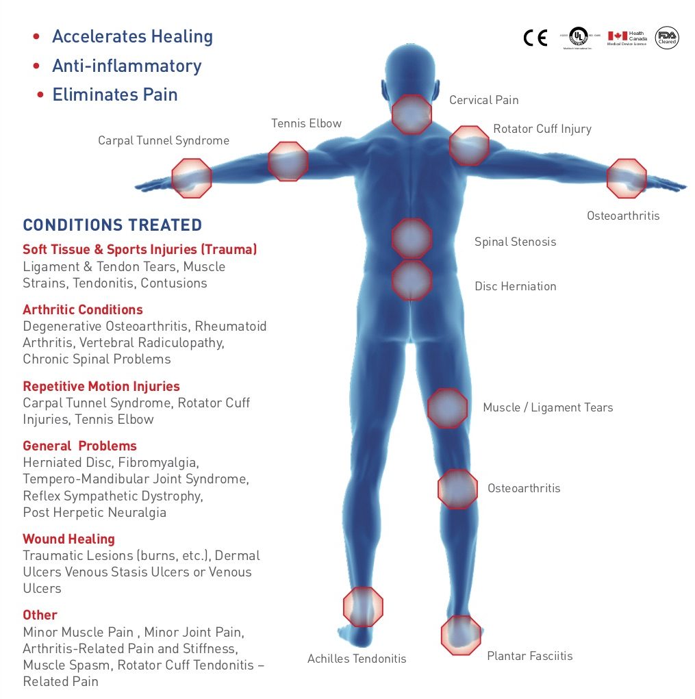 Laser Treatments - IPA Physio