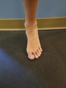Foot Structure and Function - Pronation - IPA Physio